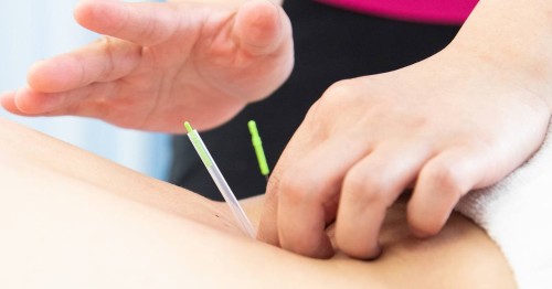 正社員 鍼灸師 訪問マッサージ・訪問鍼灸求人イメージ