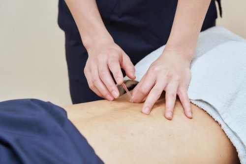 正社員 鍼灸師 接骨院・整骨院 鍼灸整骨院求人イメージ