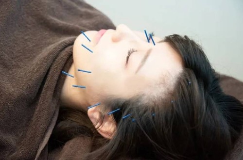 正社員 鍼灸師 接骨院・整骨院 鍼灸整骨院求人イメージ