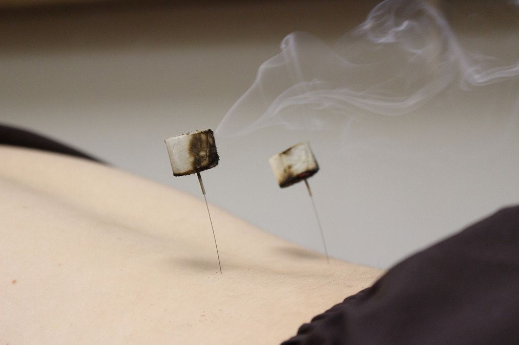 正社員 鍼灸師 接骨院・整骨院 鍼灸整骨院 鍼灸院・鍼灸サロンの求人情報イメージ4